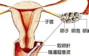 克拉玛依白碱滩区试管婴儿哪家好，克拉玛依白碱滩区医院