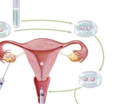 2026贵阳不孕不育医院最新排名，前三成功率高脱颖而出